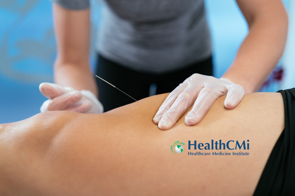 kneepainacupuncture101824