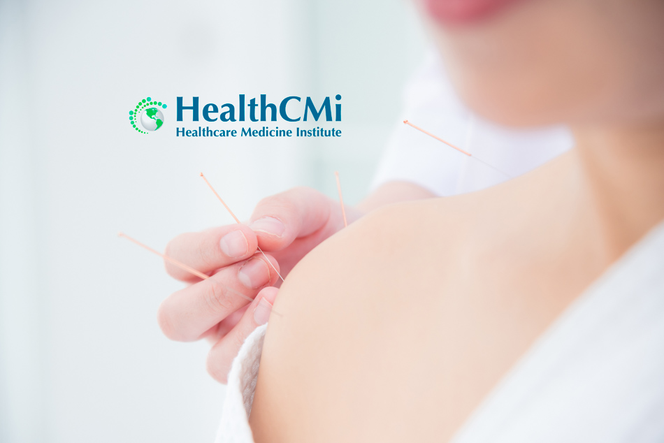 shoulderacupuncture102124