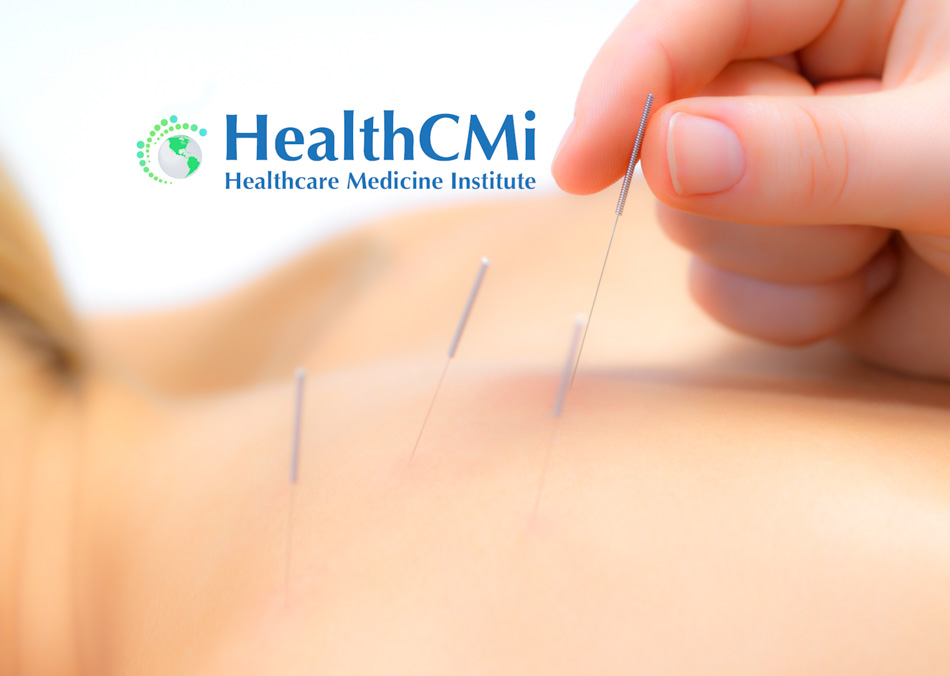 summer acupuncture top3 25