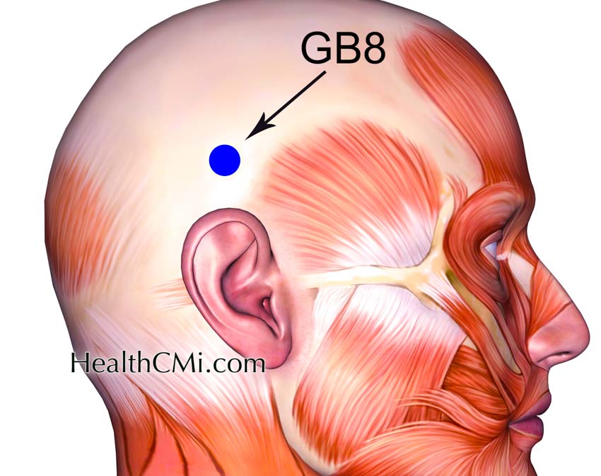 GB8 vertigoacupuncture