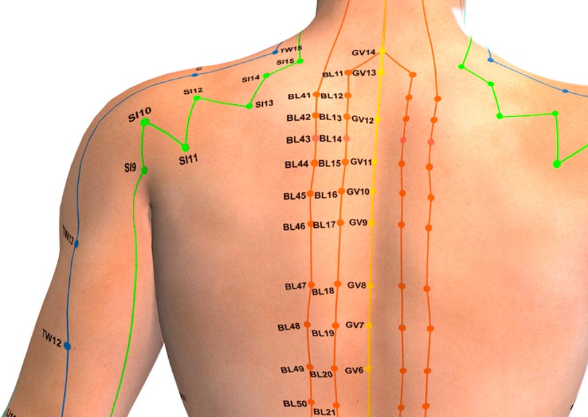 Acupuncture