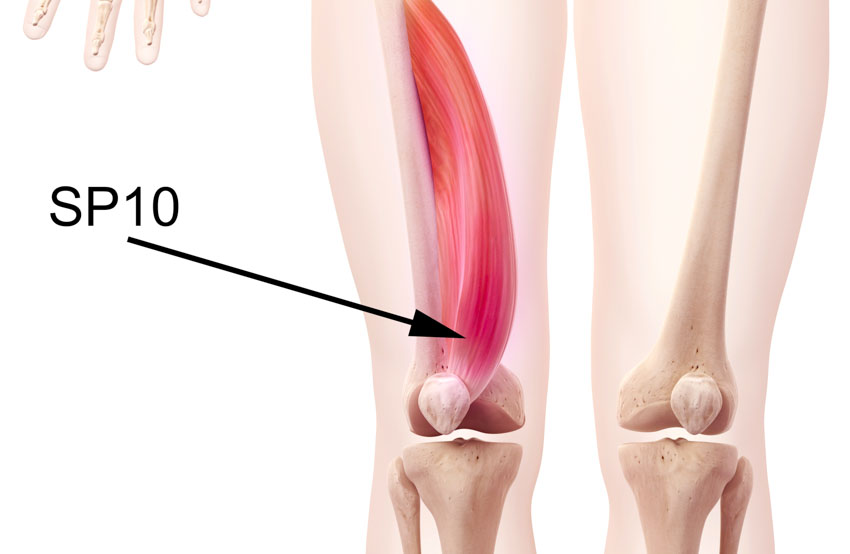 Acupuncture for Rheumatoid Arthritis Relief