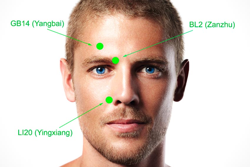 acupuncture BL2 zanzhu eyes