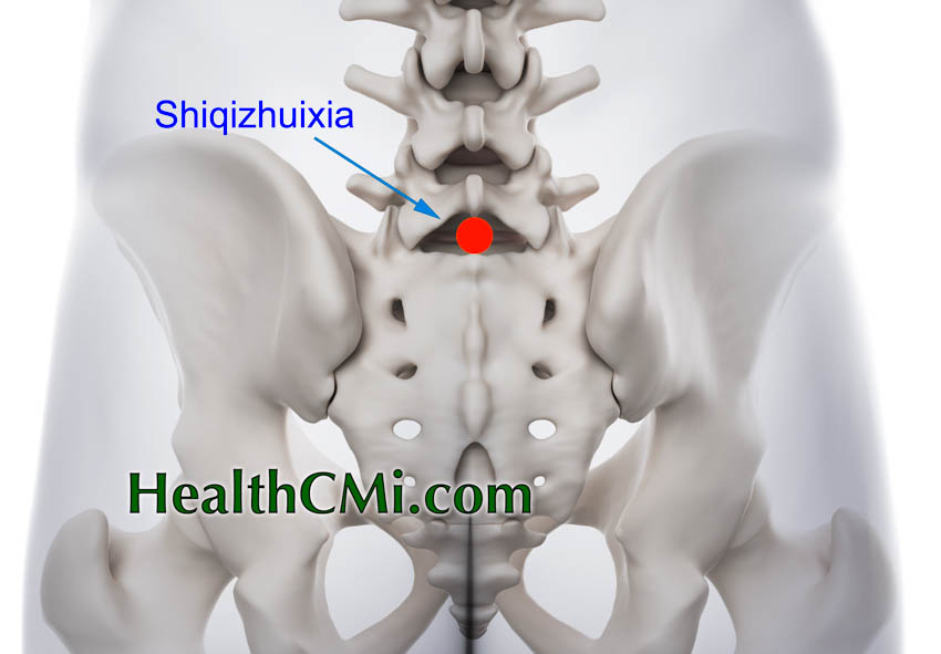 acupuncture ceus shiqi disc herniation