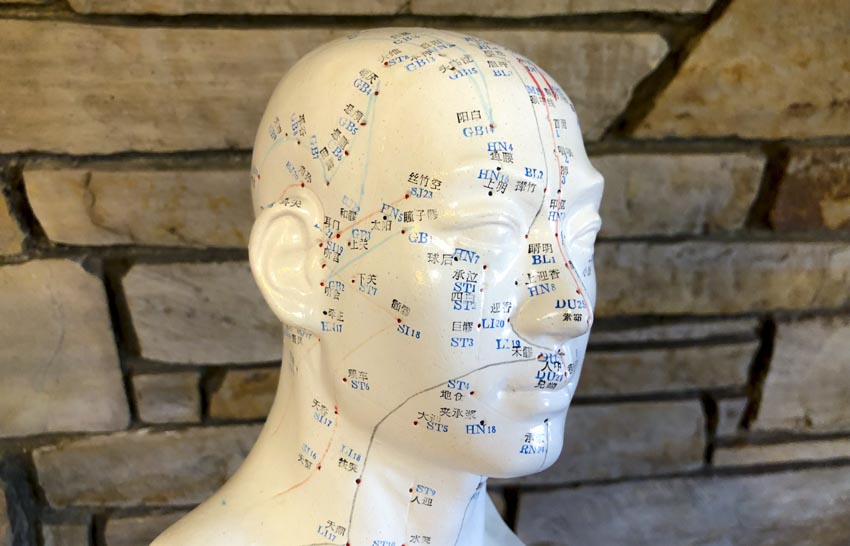 acupuncture head