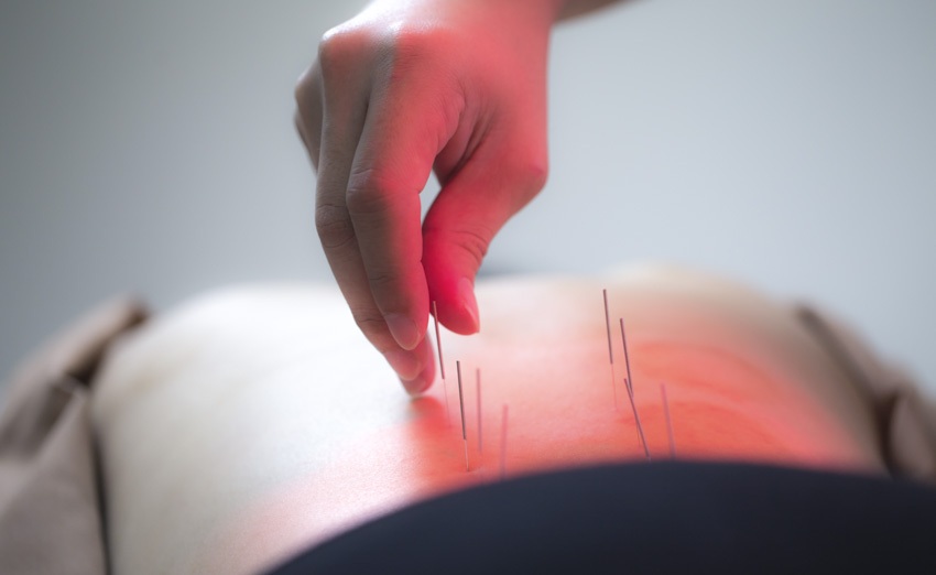 acupuncture points