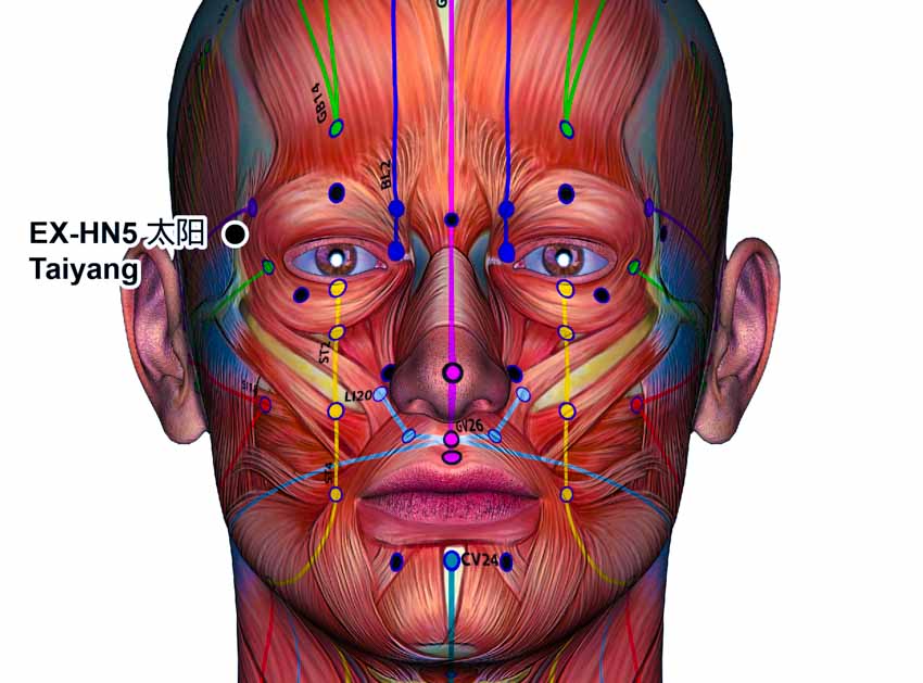 acupuncture taiyang exhn5