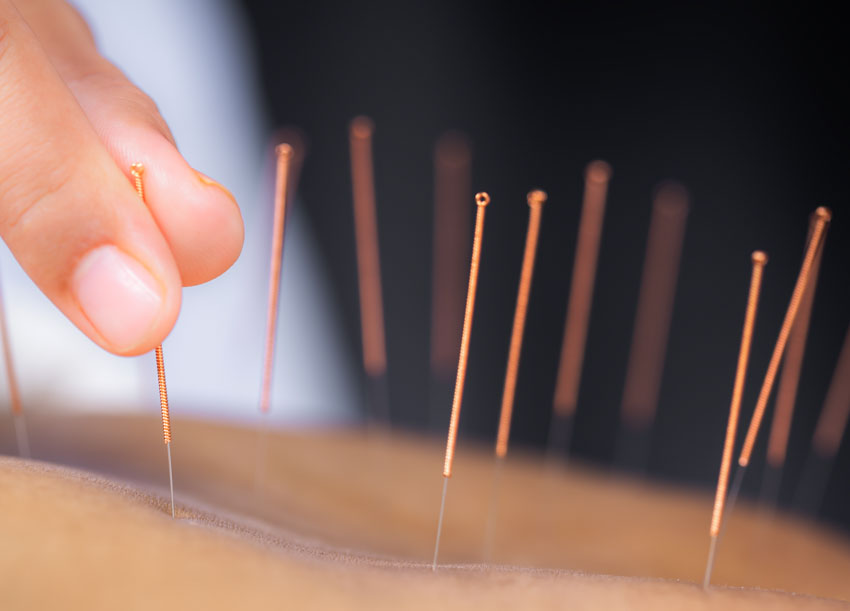 acupuncture weight loss