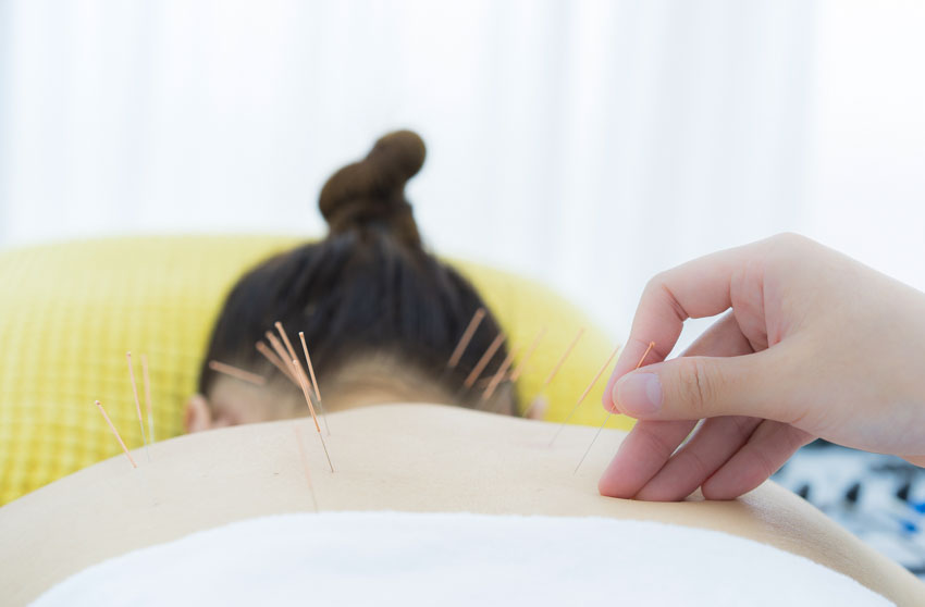 Acupuncture for Cancer Pain Relief