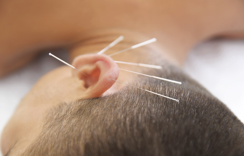 ear acupuncture