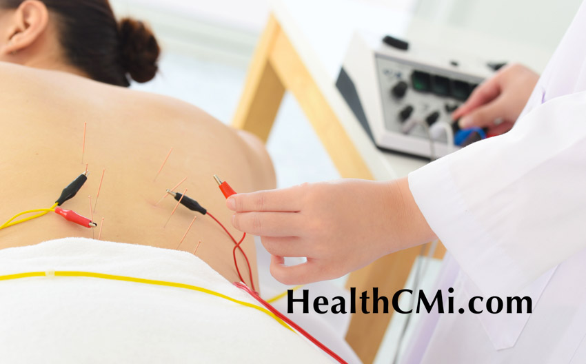 electroacupuncture with the needle connection machine used by the  acupuncturist in men. Electrical stimulation in physiotherapy to the twin  of a young man in the physiotherapy center. Stock Photo