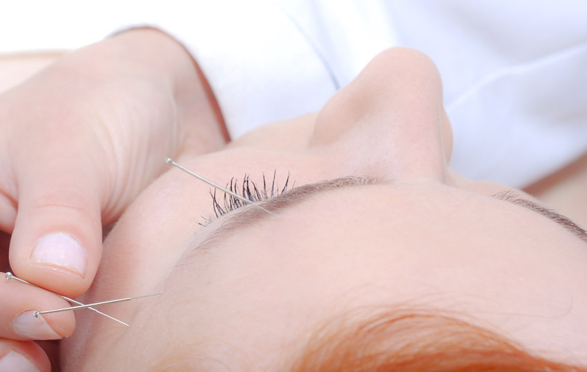 Eye Acupuncture