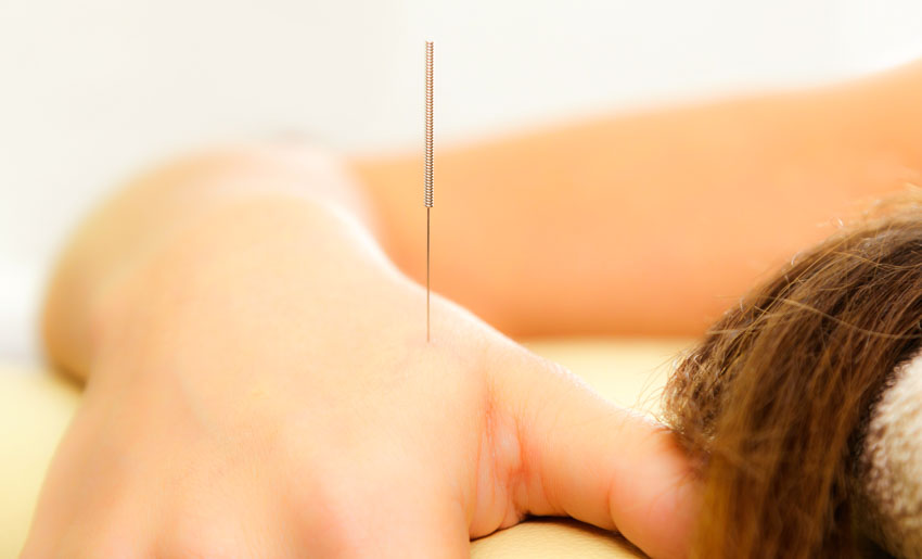 Acupuncture For Pneumonia-Induced Sepsis