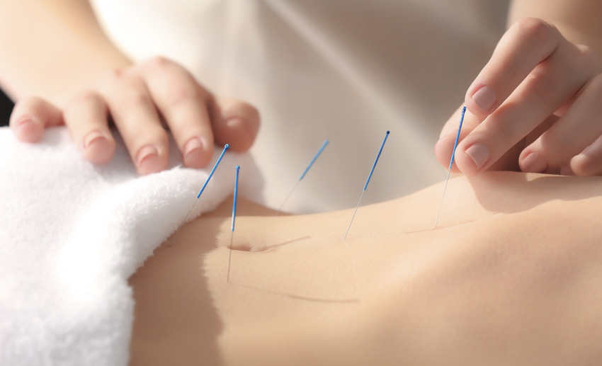 Acupuncture and Fertility - Is Acupuncture a Good Natural Fertility Treatment?