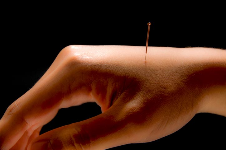 Acupuncture Depression Treatment - The Alternative Solution to Anti-Depressants