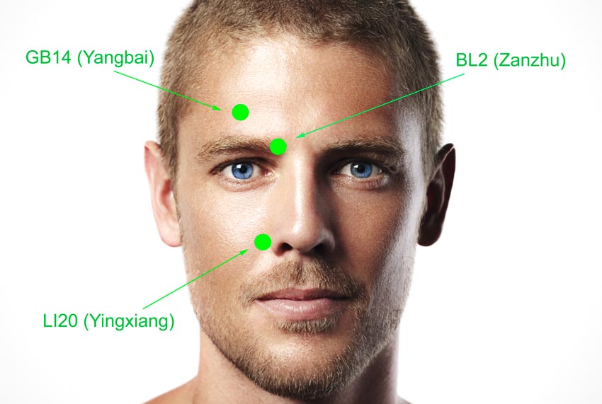 Facial Rejuvenation Cosmetic Acupuncture Points Chart.