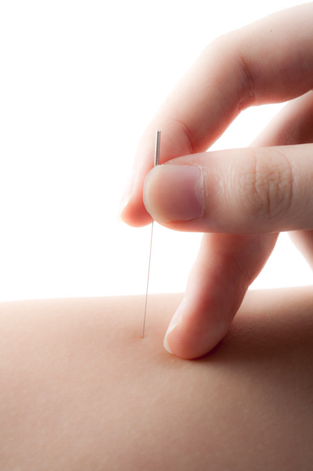 Individual needle on skin