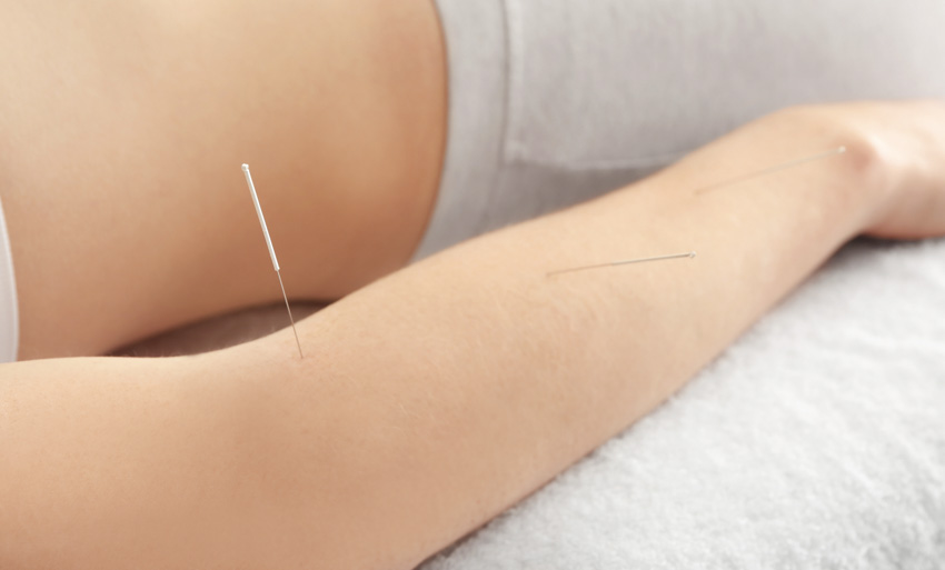 elbow acupuncture