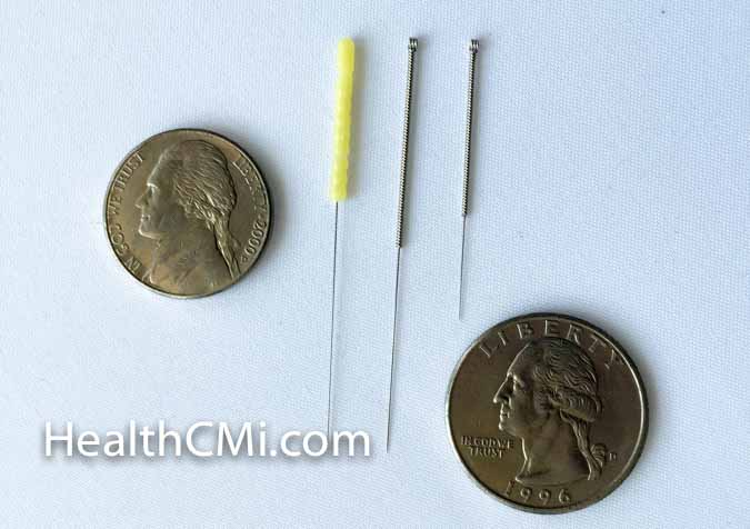 Japanese and Chinese needles compared with coins for size comarison