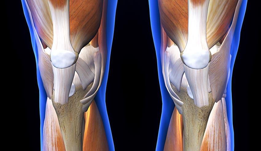 repair knee cartilage naturally