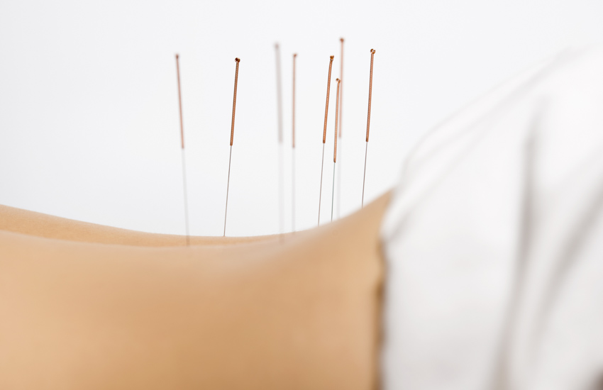 low back needles