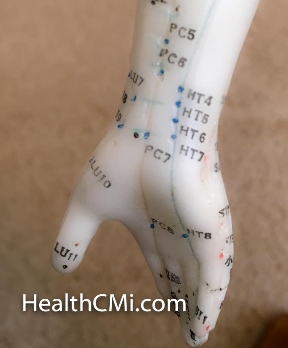 Pericardium channel on acudoll