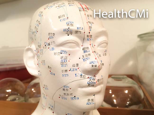 Acupuncture Combats Baldness, Outperforms Drug Therapy