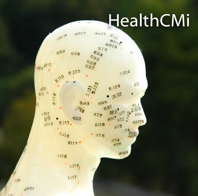 Side view of scalp points