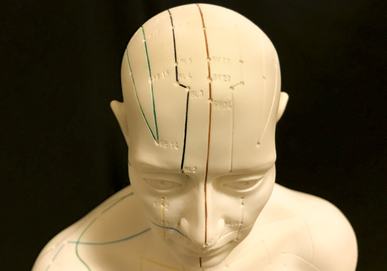 Scalp acupuncture