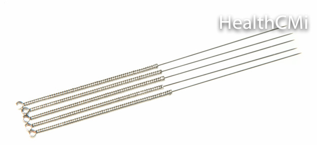 Stainless steel acupuncture needle with wound handle 