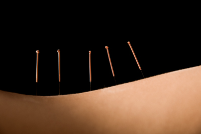 acupuncture continuing education