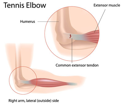 Elbow anatomy