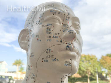 Scalp acupuncture. 