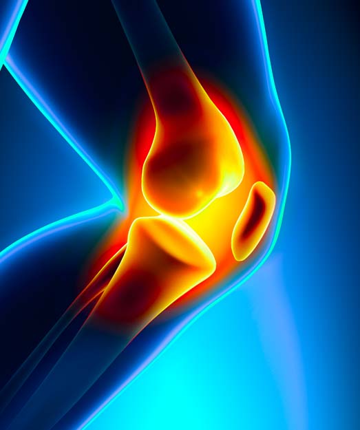 Knee pain 