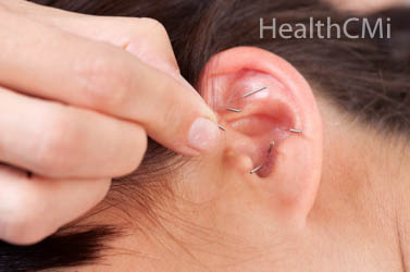 Anxiety and fear are alleviated with auricular, scalp, and Jiaji points. 