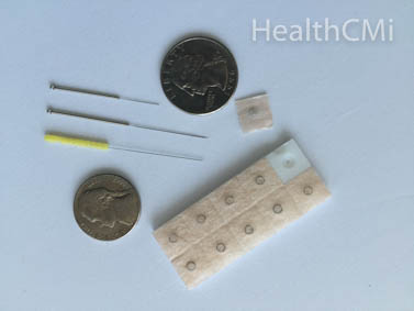 Selection of needles and ear tacks. 