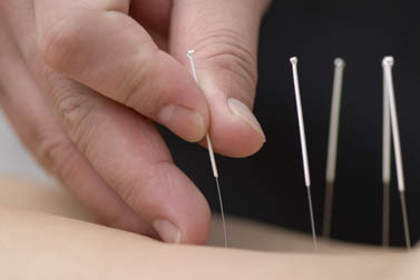 Hand applying needles shown. 