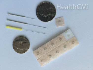 Sample of ear tacks and filiform needles 
