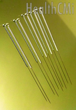 Several stainless steel filiform acupuncture needles are shown in this image. 