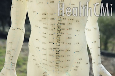 Laser Acupuncture Metabolic Weight Loss Study