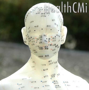 Image of an acupuncture doll's head with acupoints. 