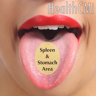The TCM stomach area of the tongue is shown in this image. 