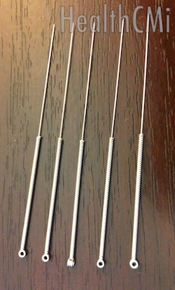 Image of needles used for tennis elbow. 