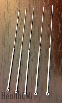 The image contains five 32 gauge acupuncture needles made of stainless steel. 