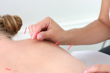 Safety In Acupuncture 1