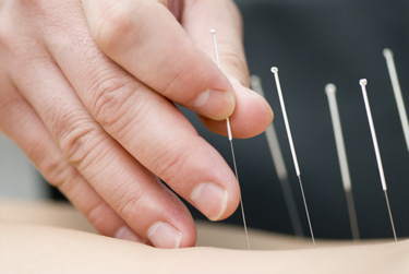 Safety in Acupuncture #2