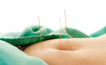 Acupuncture is shown at ST25 and CV6. 