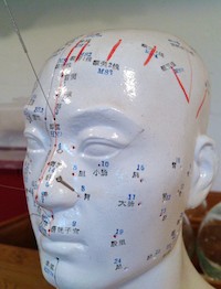 Acupuncture lowers dementia syndromes. 