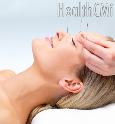 Electroacupuncture combined with physiotherapy was found especially effective in the treatment of facial paralysis. 