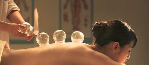 Fire cupping is applied in many acupuncture practices. 